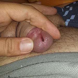 peehole Galeriebild