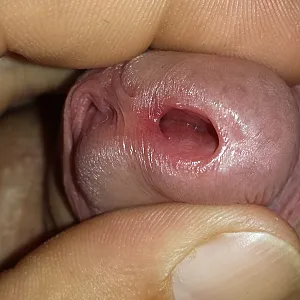 peehole Galeriebild