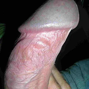 cock gallery gallery image