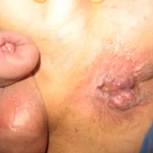 ball and butt pumping gallery image