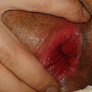 the Ass Hole gallery image
