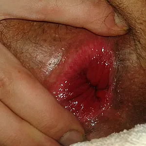 the Ass Hole gallery image