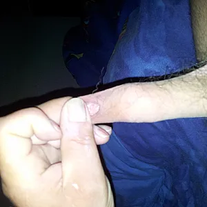 My dick gallery image