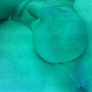 Im Solarium Galeriebild