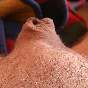 my cock gallery image