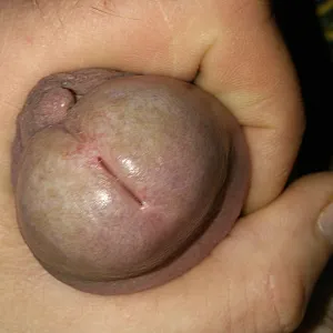 my cock gallery image