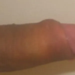 closeups 2 gallery image