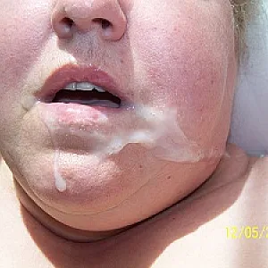 Mund und Gesichtsbesamung Galeriebild