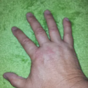 Es kommt und meine Hand Galeriebild