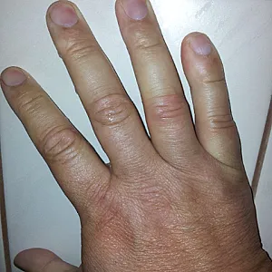 Es kommt und meine Hand Galeriebild