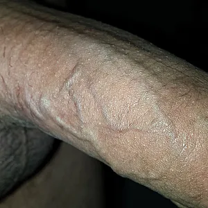 me gallery image