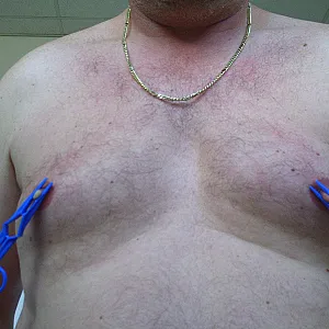 Nipples gallery image