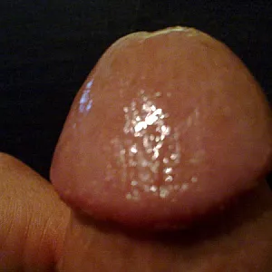 my dick gallery image