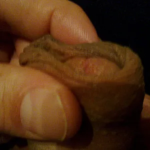 my dick gallery image