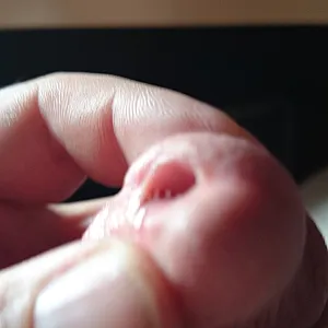 my little dick gallery image