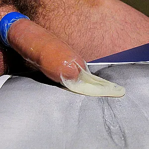 Sperma im Kondom Galeriebild