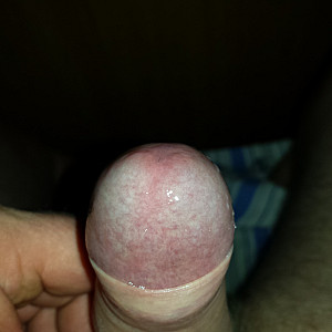 my cock gallery image