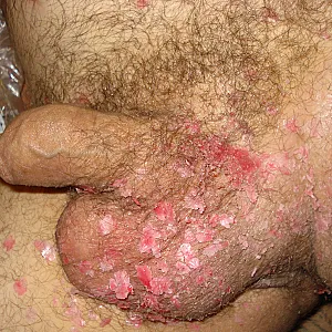 some more photos from my lady gallery image