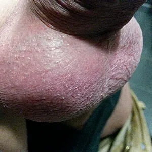 hard cock gallery image