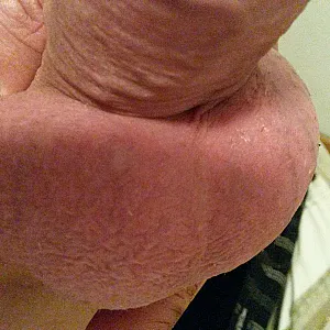 hard cock gallery image