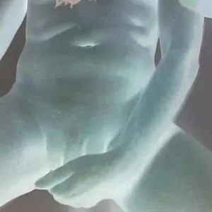 mixed gallery image