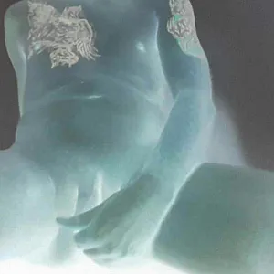 mixed gallery image