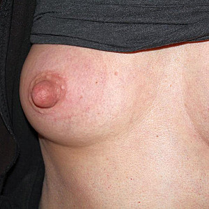 Nippel. Galeriebild