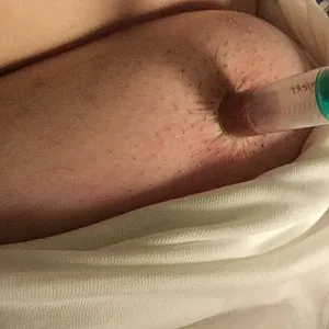 Tiefes 10mm Penis-Sounding und Nipple-Stretching Galeriebild