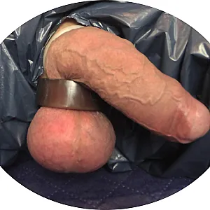 Stinging nettles on balls gallery image