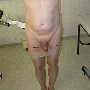 dicktreatment gallery image
