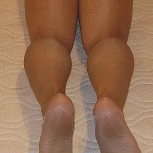 balldildo gallery image