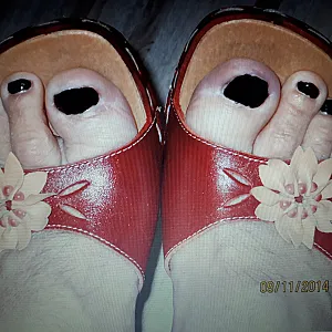 Feets gallery image