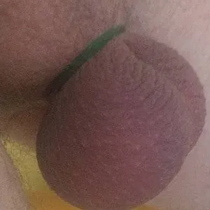 Batterien in den Vibrator gesteckt ohne Erfolg Galeriebild