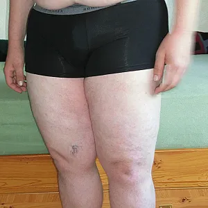 my body gallery image