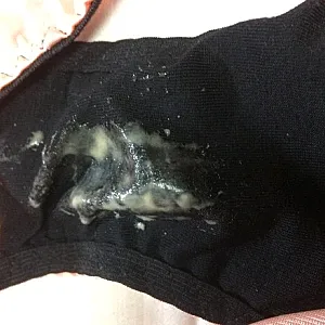 sperm slips gallery image