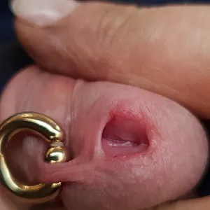 Peehole gallery image