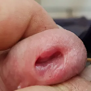 Peehole gallery image