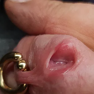 Peehole gallery image