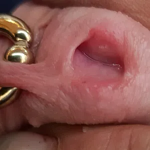 Peehole gallery image