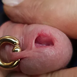 Peehole gallery image