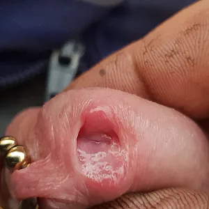 Peehole gallery image