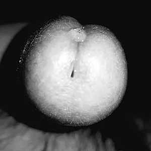 my dick gallery image
