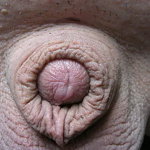 Minischwänzchen oder Clit? Galeriebild