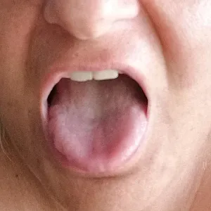 sucked gallery image