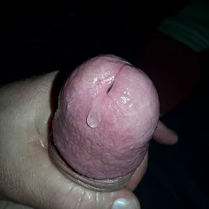 My dick gallery image