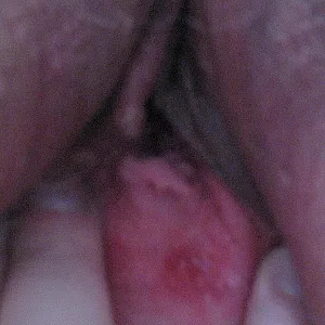 Fisting gallery image