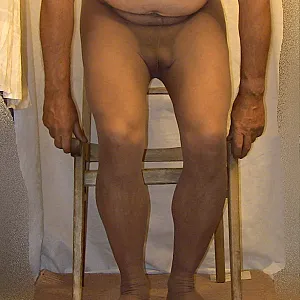 Schlauch im Stuhl 1 Galeriebild