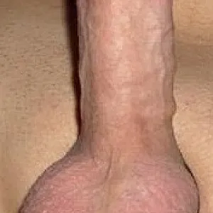 Ich Galeriebild