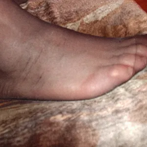 My feet gallery image
