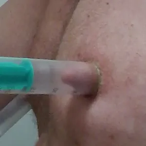 Nippel Galeriebild